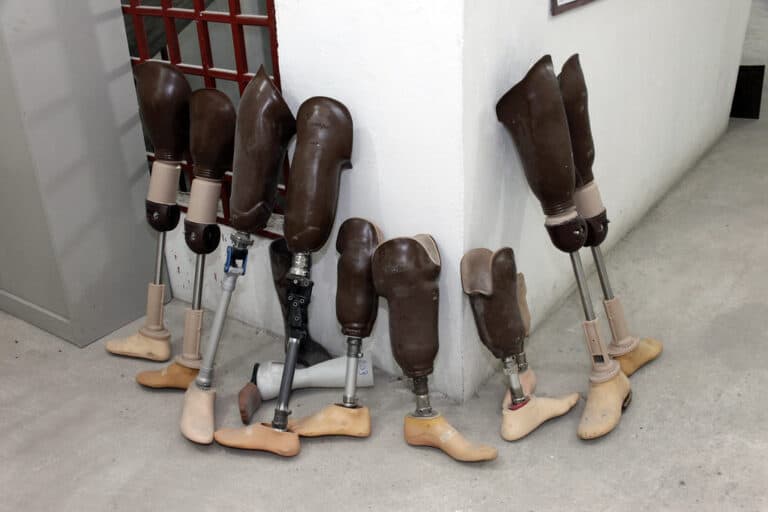 Hiking Prosthetic Maintenance